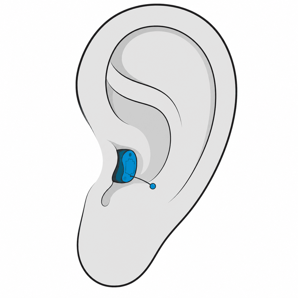 Completely-in-Canal (CIC) hearing aid style available at Comprehensive Hearing Solutions in Pittsburg, KS
