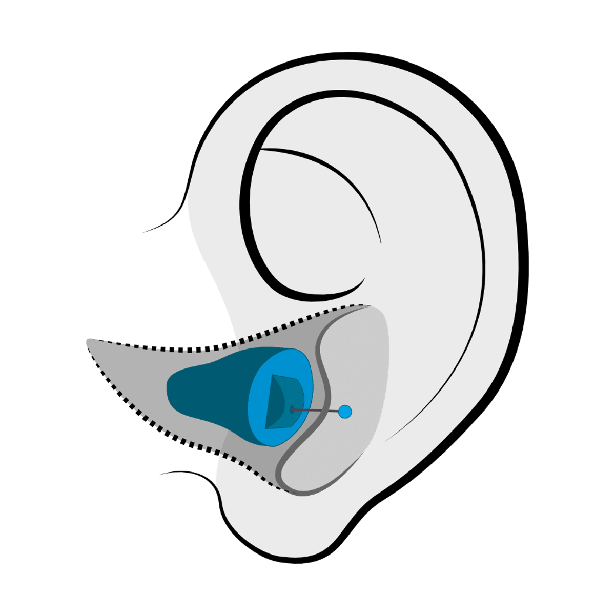 Invisible-in-Canal (IIC) hearing aid style available at Comprehensive Hearing Solutions in Pittsburg, KS