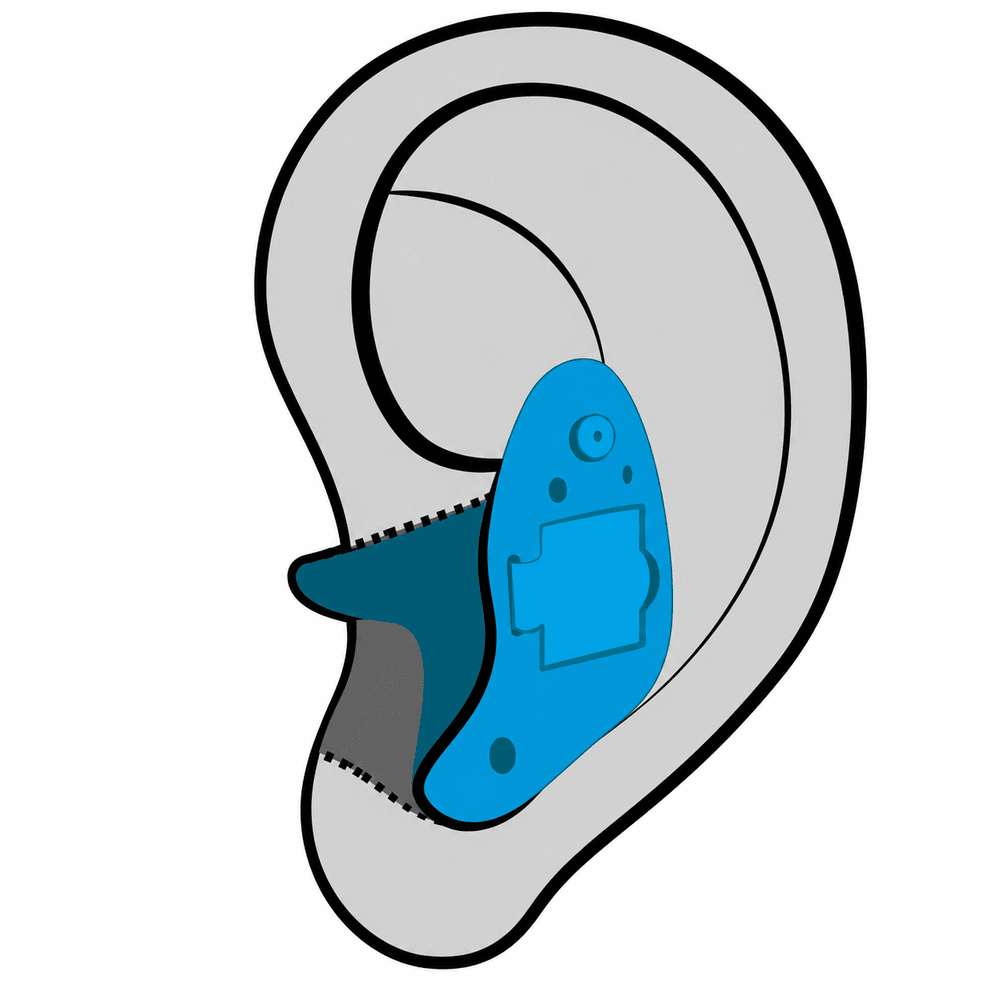 In-the-Ear (ITE) hearing aid style available at Comprehensive Hearing Solutions in Pittsburg, KS